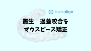 叢生 過蓋咬合をインビザラインはIPRとバイトランプが必須 お口の再生博士のサムネイル画像