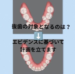 出っ歯 叢生の抜歯をインビザラインで矯正はⅡ級ゴムかけが必要 お口の再生博士のサムネイル画像