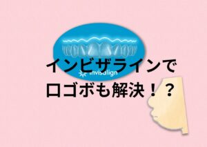 上下前突の口ゴボを抜歯してインビザラインで矯正 ゴムかけは必須 お口の再生博士のサムネイル画像