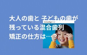 出っ歯を子供用インビザラインファーストで矯正はゴムかけが必要 お口の再生博士のサムネイル画像