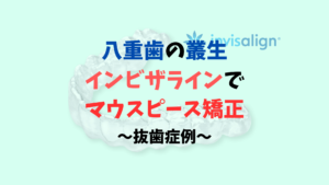 八重歯の叢生　抜歯症例をインビザラインは奥歯がパカパカしないよう注意が 必要　お口の再生博士のサムネイル画像