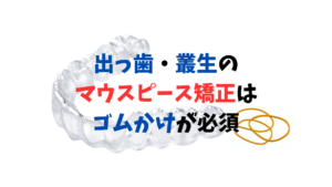 出っ歯　叢生はゴムかけが必須　インビザラインのジェネリック　クリアコレクトで矯正しました　お口の再生博士のサムネイル画像