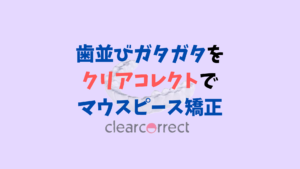 叢生をインビザラインのジェネリック　クリアコレクトで矯正　お口の再生博士のサムネイル画像