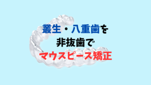 叢生で八重歯を非抜歯でインビザライン希望　上と下の歯がズレているのも気になります　お口の再生博士のサムネイル画像