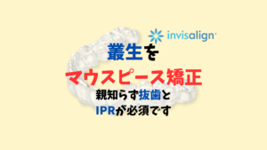 叢生をインビザラインで矯正は親知らずの抜歯とＩＰＲが必須　お口の再生博士のサムネイル画像